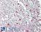Zinc Finger Protein 335 antibody, LS-B13549, Lifespan Biosciences, Immunohistochemistry paraffin image 