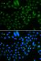 AlkB Homolog 8, TRNA Methyltransferase antibody, orb373549, Biorbyt, Immunofluorescence image 