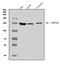 Kinesin Family Member 5A antibody, A03635-1, Boster Biological Technology, Western Blot image 