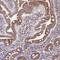 Spermidine/Spermine N1-Acetyltransferase 1 antibody, NBP2-37947, Novus Biologicals, Immunohistochemistry paraffin image 