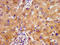 NADH:Ubiquinone Oxidoreductase Complex Assembly Factor 2 antibody, LS-C674571, Lifespan Biosciences, Immunohistochemistry paraffin image 