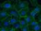 Coagulation Factor III, Tissue Factor antibody, GTX02063, GeneTex, Immunocytochemistry image 