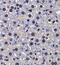 RHE antibody, FNab03131, FineTest, Immunohistochemistry paraffin image 