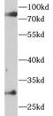 Complement C1r antibody, FNab09885, FineTest, Western Blot image 