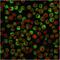 CD79a antibody, AE00108, Aeonian Biotech, Immunocytochemistry image 
