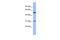 RNA Binding Motif Single Stranded Interacting Protein 3 antibody, GTX47424, GeneTex, Western Blot image 