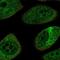 Neurofilament Light antibody, HPA015021, Atlas Antibodies, Immunocytochemistry image 