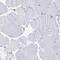 CD2 Cytoplasmic Tail Binding Protein 2 antibody, PA5-59603, Invitrogen Antibodies, Immunohistochemistry frozen image 