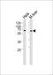 Sequestosome 1 antibody, MBS9212103, MyBioSource, Western Blot image 