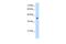 Kynurenine Aminotransferase 3 antibody, PA5-41727, Invitrogen Antibodies, Western Blot image 