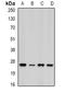 Proteasome Subunit Alpha 5 antibody, orb340964, Biorbyt, Western Blot image 