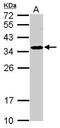 Spermidine Synthase antibody, GTX119072, GeneTex, Western Blot image 