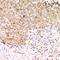 Acid Phosphatase 1 antibody, LS-C668001, Lifespan Biosciences, Immunohistochemistry paraffin image 