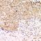 Acid Phosphatase antibody, LS-C668001, Lifespan Biosciences, Immunohistochemistry paraffin image 