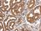 Myosin-Ia antibody, NBP2-19452, Novus Biologicals, Immunohistochemistry paraffin image 
