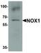 NADPH Oxidase 1 antibody, LS-C336196, Lifespan Biosciences, Western Blot image 