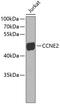 Cyclin E2 antibody, 22-644, ProSci, Western Blot image 