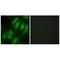 HEXIM P-TEFb Complex Subunit 1 antibody, A02321-1, Boster Biological Technology, Immunohistochemistry paraffin image 