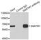 Sequestosome 1 antibody, LS-C746989, Lifespan Biosciences, Immunoprecipitation image 