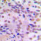 CAMP Responsive Element Binding Protein 1 antibody, GTX32165, GeneTex, Immunohistochemistry paraffin image 