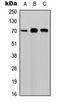 Colony Stimulating Factor 1 antibody, LS-B15826, Lifespan Biosciences, Western Blot image 