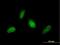 RING finger protein 114 antibody, H00055905-B01P, Novus Biologicals, Immunocytochemistry image 