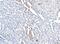 Hemoglobin Subunit Alpha 2 antibody, A00233-2, Boster Biological Technology, Immunohistochemistry paraffin image 