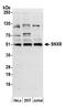 Sorting Nexin 8 antibody, A304-974A, Bethyl Labs, Western Blot image 