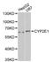 Cytochrome P450 Family 2 Subfamily E Member 1 antibody, STJ111078, St John
