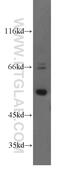 Transcriptional Adaptor 2B antibody, 17367-1-AP, Proteintech Group, Western Blot image 