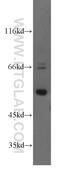 Transcriptional adapter 2-beta antibody, 17367-1-AP, Proteintech Group, Western Blot image 