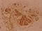 SUMO Specific Peptidase 1 antibody, GTX66632, GeneTex, Immunohistochemistry paraffin image 