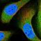 Ankyrin Repeat Domain 50 antibody, HPA044008, Atlas Antibodies, Immunofluorescence image 