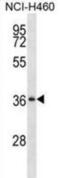 Serpin Family B Member 1 antibody, abx028623, Abbexa, Western Blot image 