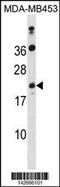 Distal Membrane Arm Assembly Complex 2 Like antibody, 60-945, ProSci, Western Blot image 