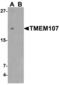 Transmembrane Protein 107 antibody, LS-B10131, Lifespan Biosciences, Western Blot image 