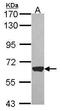 Acyl-CoA Dehydrogenase Very Long Chain antibody, PA5-29959, Invitrogen Antibodies, Western Blot image 