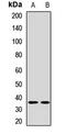 Lymphatic Vessel Endothelial Hyaluronan Receptor 1 antibody, LS-C668713, Lifespan Biosciences, Western Blot image 