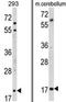 Myelin Associated Oligodendrocyte Basic Protein antibody, AP17564PU-N, Origene, Western Blot image 