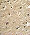 Protein Inhibitor Of Activated STAT 4 antibody, PA5-11347, Invitrogen Antibodies, Immunohistochemistry paraffin image 