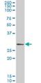 Glutamate-Cysteine Ligase Modifier Subunit antibody, H00002730-M01, Novus Biologicals, Western Blot image 