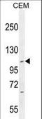 Intraflagellar Transport 88 antibody, LS-B9610, Lifespan Biosciences, Western Blot image 