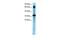 TGF-Beta Activated Kinase 1 (MAP3K7) Binding Protein 2 antibody, GTX77824, GeneTex, Western Blot image 