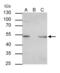 Integrin Linked Kinase antibody, GTX101691, GeneTex, Immunoprecipitation image 