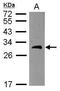BCAS2 Pre-MRNA Processing Factor antibody, GTX115390, GeneTex, Western Blot image 
