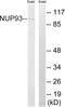 Nucleoporin 93 antibody, PA5-39309, Invitrogen Antibodies, Western Blot image 