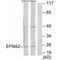 Ephrin A2 antibody, A09844, Boster Biological Technology, Western Blot image 