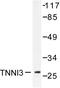 Troponin I3, Cardiac Type antibody, LS-C176329, Lifespan Biosciences, Western Blot image 