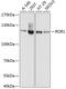 Receptor Tyrosine Kinase Like Orphan Receptor 1 antibody, 19-032, ProSci, Western Blot image 