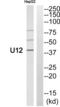 G-protein coupled receptor homolog U12 antibody, abx015527, Abbexa, Western Blot image 